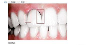 成人牙床图片大全视频,揭秘牙齿排列与口腔健康