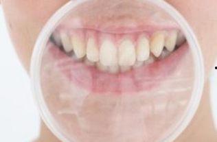 成人修磨牙视频大全,成人修磨牙技巧与案例大盘点